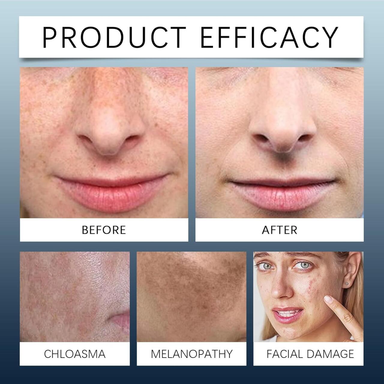 Kit Crema Hidratante de Día y Noche con Extracto de Centella Asiática 🌙☀️🌿